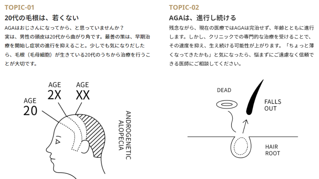 TOPIC-01：20代の毛根は、若くない