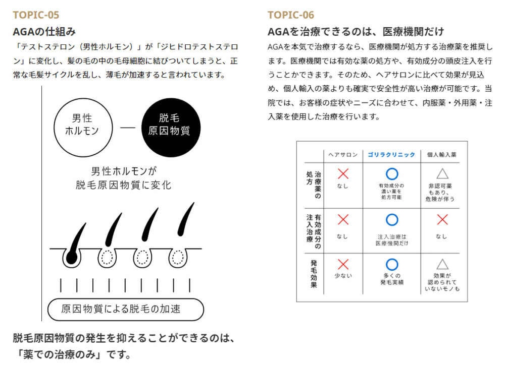 TOPIC-05：AGAの仕組み